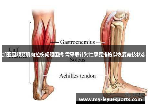 加亚因频繁肌肉拉伤问题困扰 需采取针对性康复措施以恢复竞技状态 加亚因频繁肌肉拉伤问题困扰 需采取针对性康复措施以恢复竞技状态